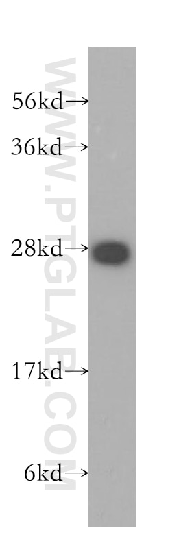 Western Blot (WB) analysis of HeLa cells using PTGDS Polyclonal antibody (10754-2-AP)