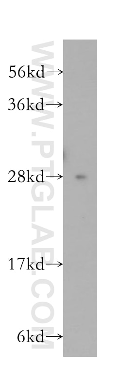 Western Blot (WB) analysis of human colon tissue using PTGDS Polyclonal antibody (10754-2-AP)