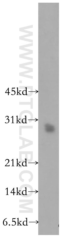 Western Blot (WB) analysis of human heart tissue using PTGDS Polyclonal antibody (10754-2-AP)