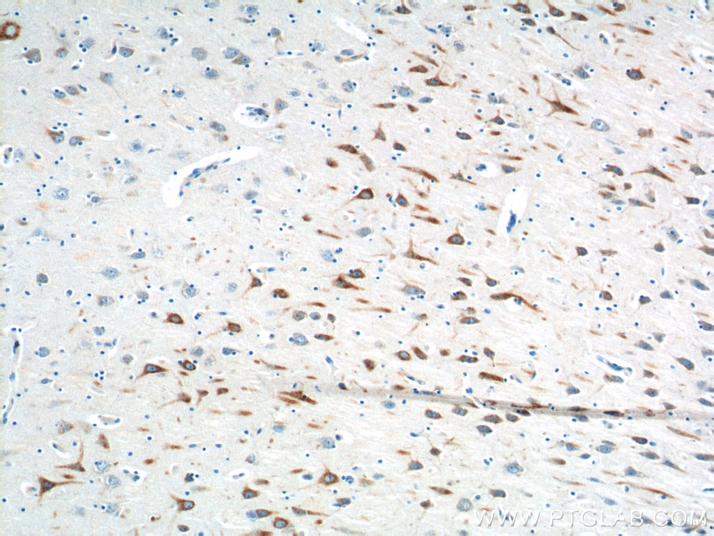Immunohistochemistry (IHC) staining of human brain tissue using PTGER3 Polyclonal antibody (14357-1-AP)