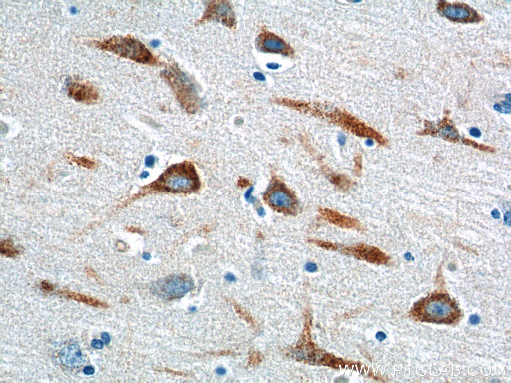 Immunohistochemistry (IHC) staining of human brain tissue using PTGER3 Polyclonal antibody (14357-1-AP)