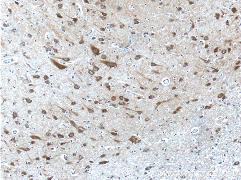 Immunohistochemistry (IHC) staining of human brain tissue using PTGER3 Polyclonal antibody (24761-1-AP)