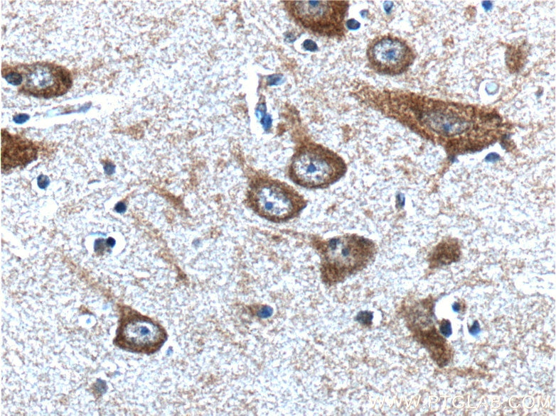 Immunohistochemistry (IHC) staining of human brain tissue using PTGER3 Polyclonal antibody (24761-1-AP)