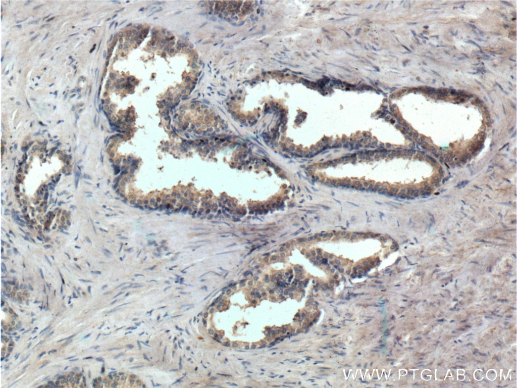 Immunohistochemistry (IHC) staining of human prostate hyperplasia tissue using PTGER4 Polyclonal antibody (24895-1-AP)