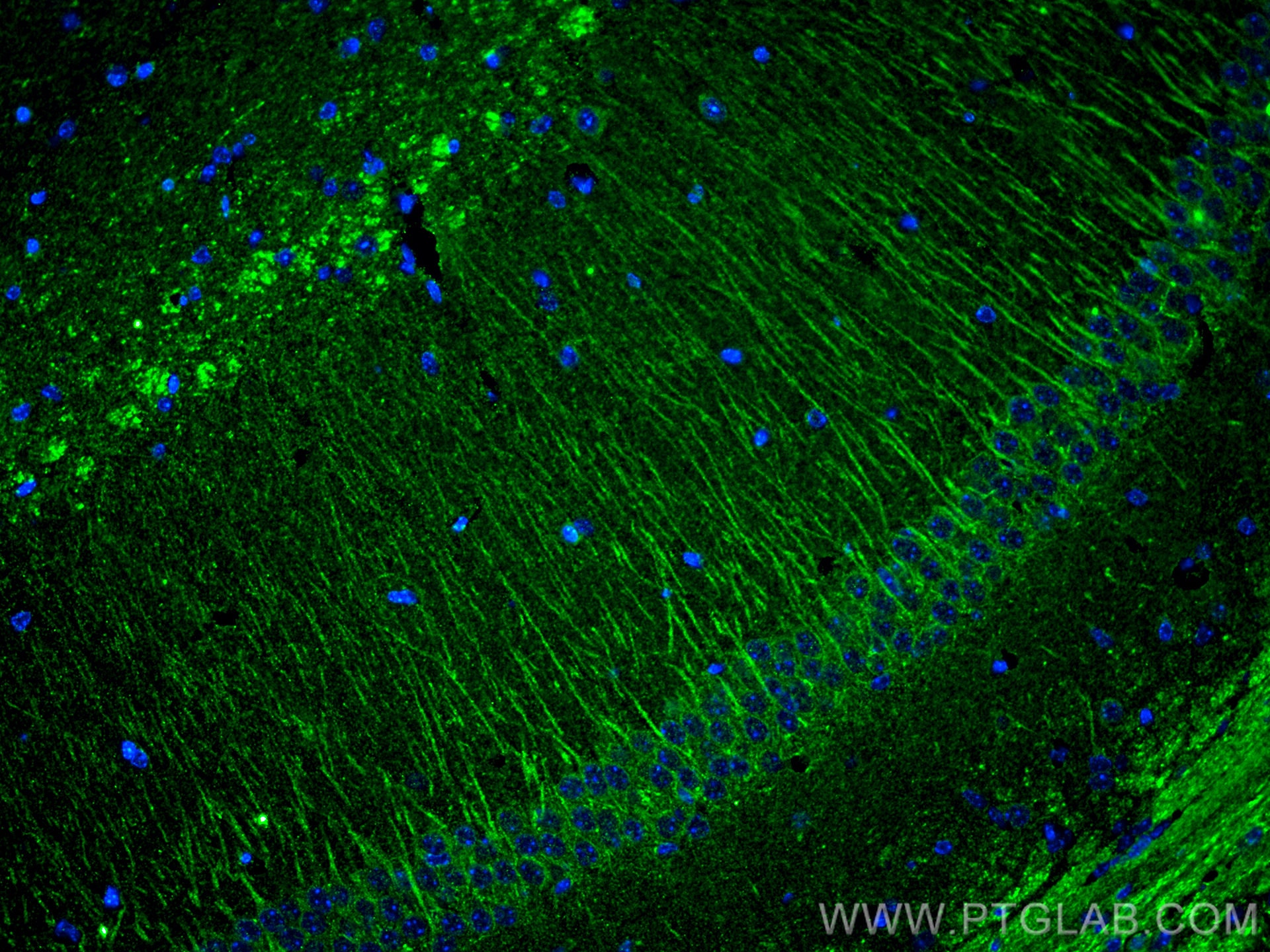 Immunofluorescence (IF) / fluorescent staining of mouse brain tissue using PTGER4 Monoclonal antibody (66921-1-Ig)