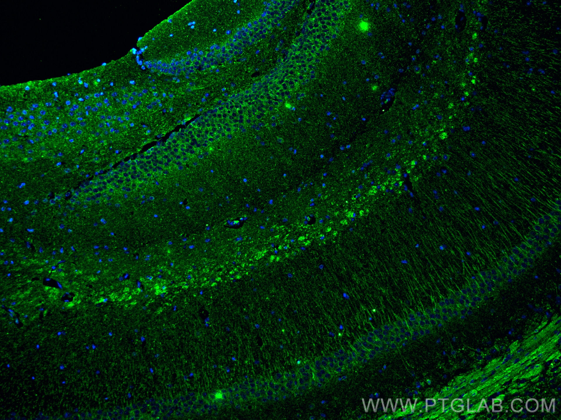 Immunofluorescence (IF) / fluorescent staining of mouse brain tissue using PTGER4 Monoclonal antibody (66921-1-Ig)