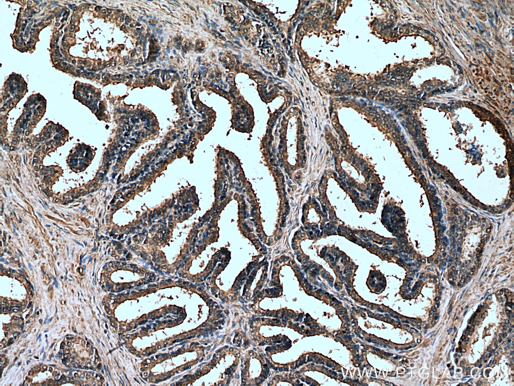 Immunohistochemistry (IHC) staining of human prostate hyperplasia tissue using PTGER4 Monoclonal antibody (66921-1-Ig)