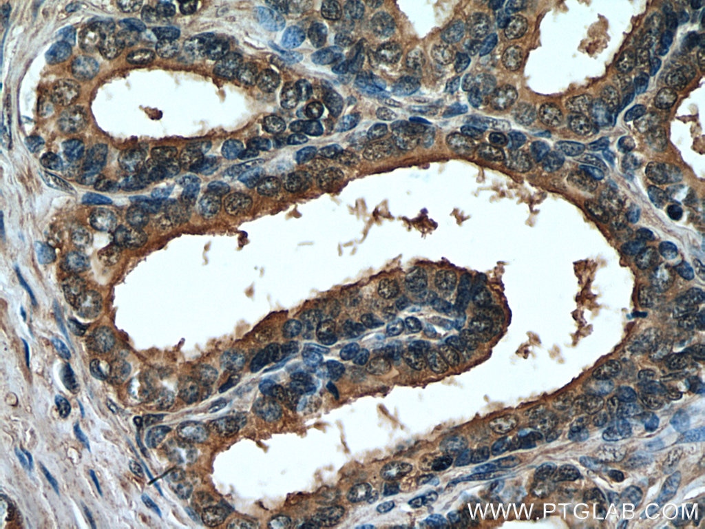 Immunohistochemistry (IHC) staining of human prostate hyperplasia tissue using PTGER4 Monoclonal antibody (66921-1-Ig)