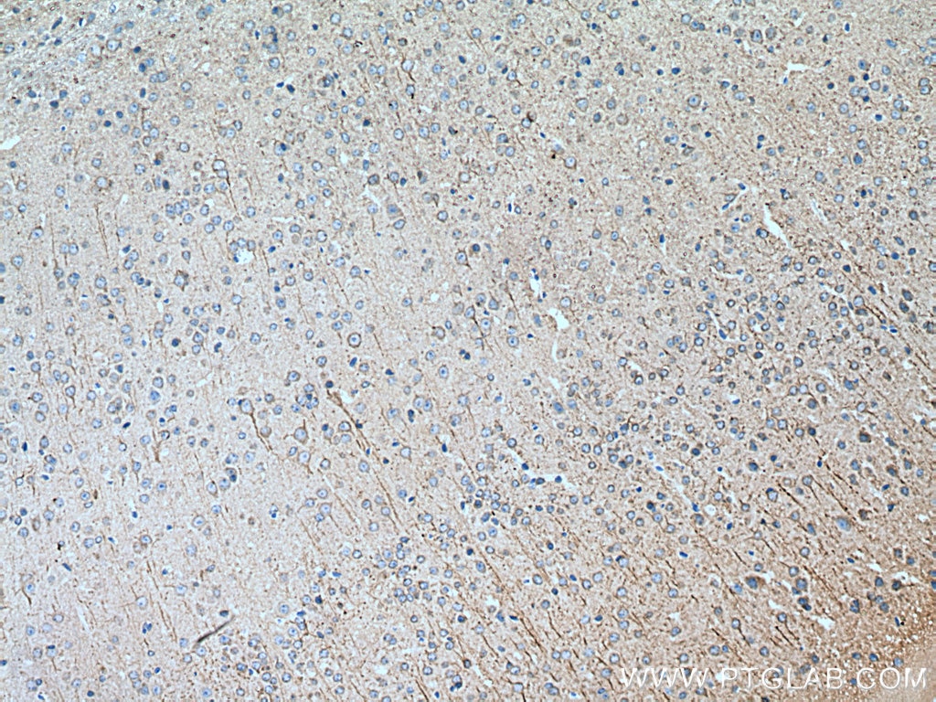 Immunohistochemistry (IHC) staining of mouse brain tissue using PTGER4 Monoclonal antibody (66921-1-Ig)