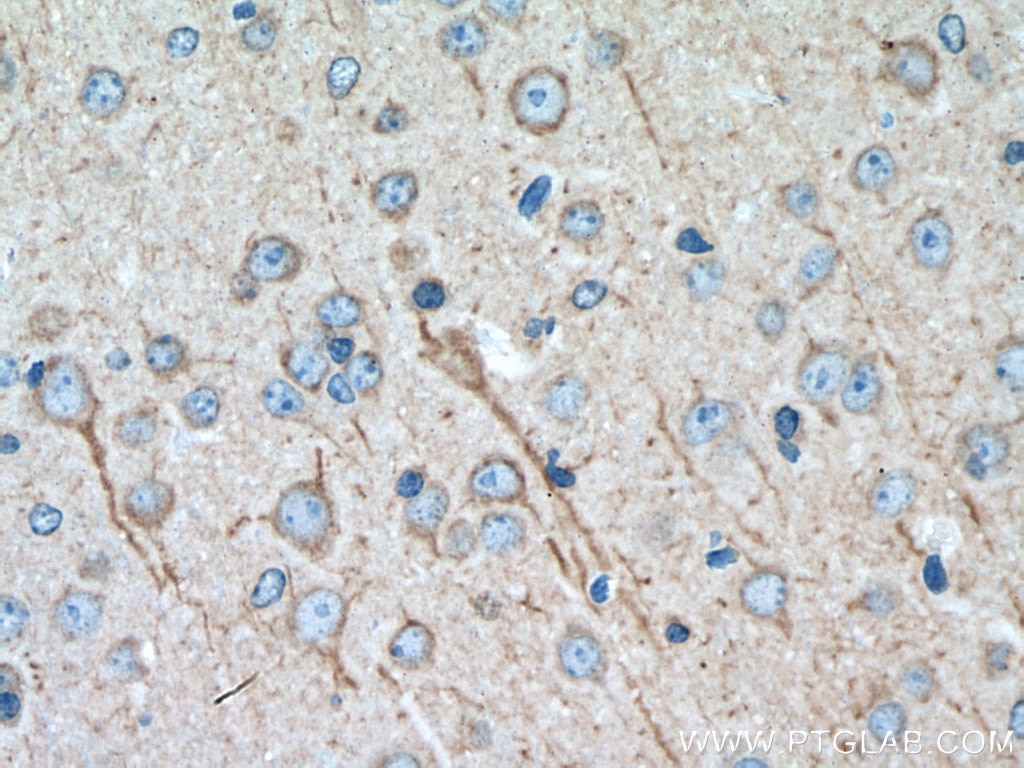 Immunohistochemistry (IHC) staining of mouse brain tissue using PTGER4 Monoclonal antibody (66921-1-Ig)