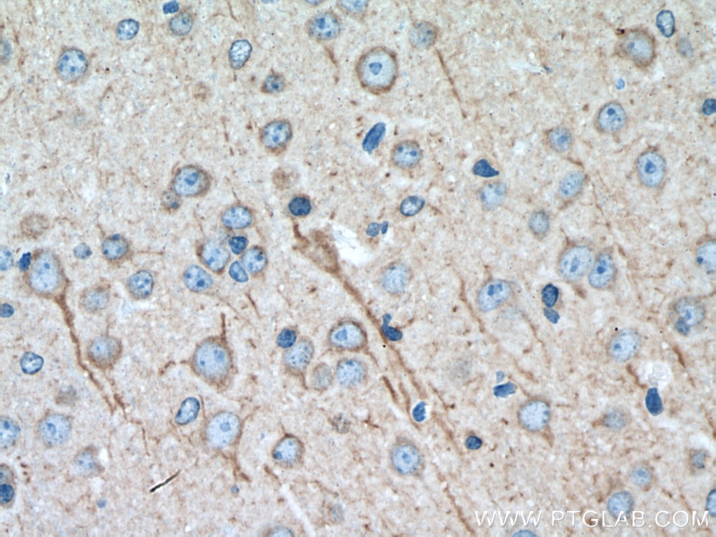 IHC staining of mouse brain using 66921-1-Ig