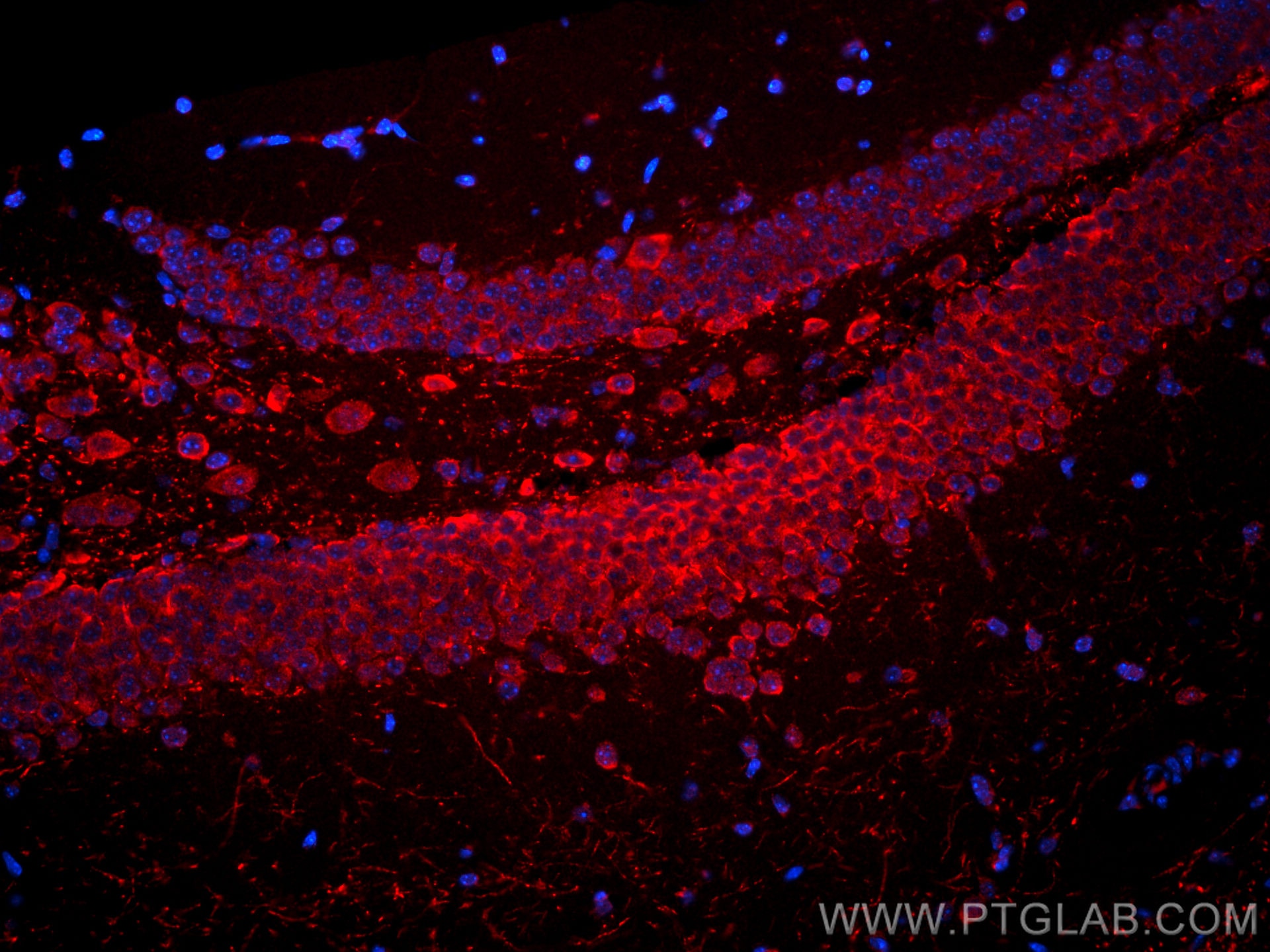 Immunofluorescence (IF) / fluorescent staining of mouse brain tissue using CoraLite®594-conjugated PTGER4 Monoclonal antibody (CL594-66921)