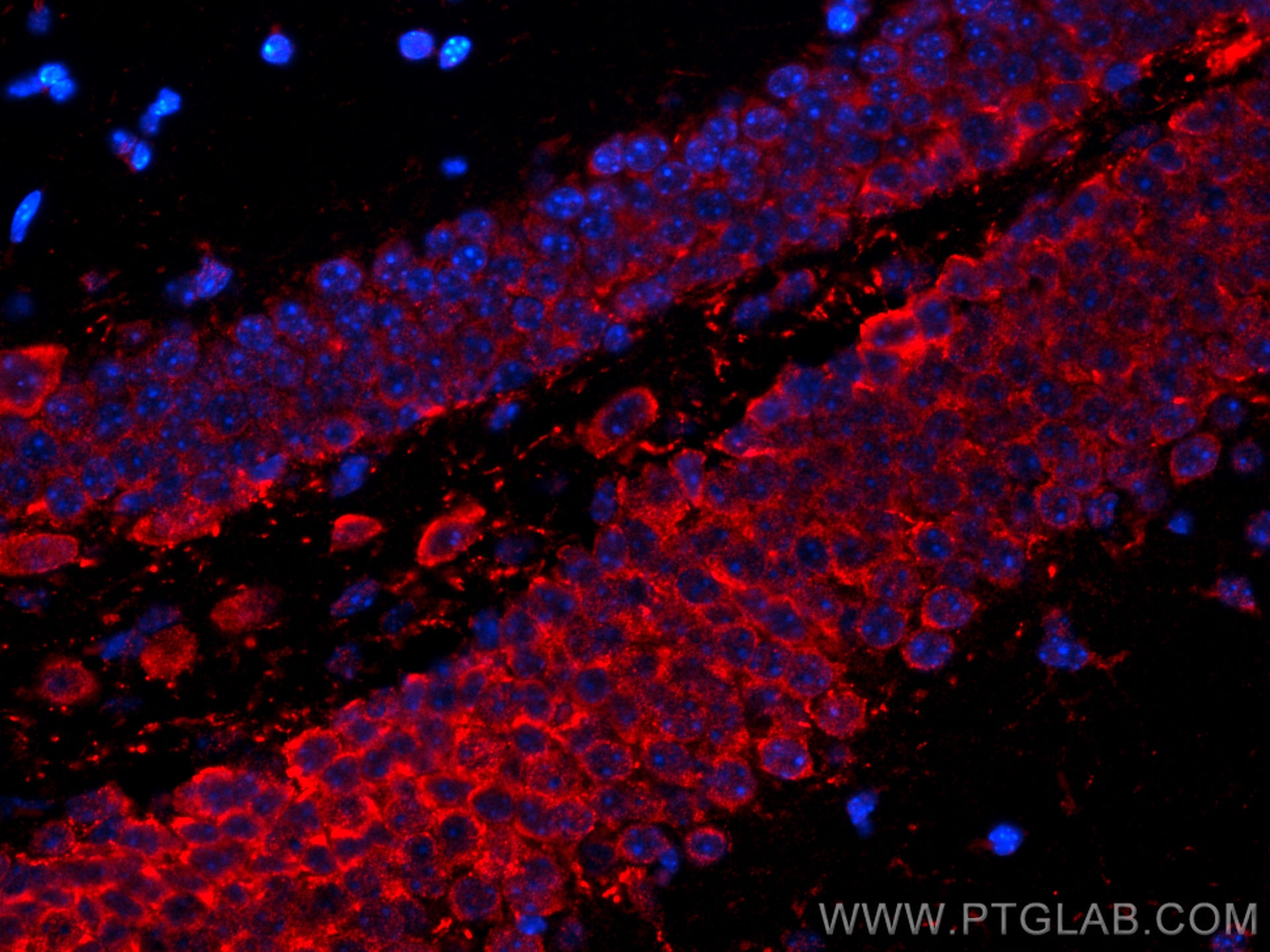 Immunofluorescence (IF) / fluorescent staining of mouse brain tissue using CoraLite®594-conjugated PTGER4 Monoclonal antibody (CL594-66921)