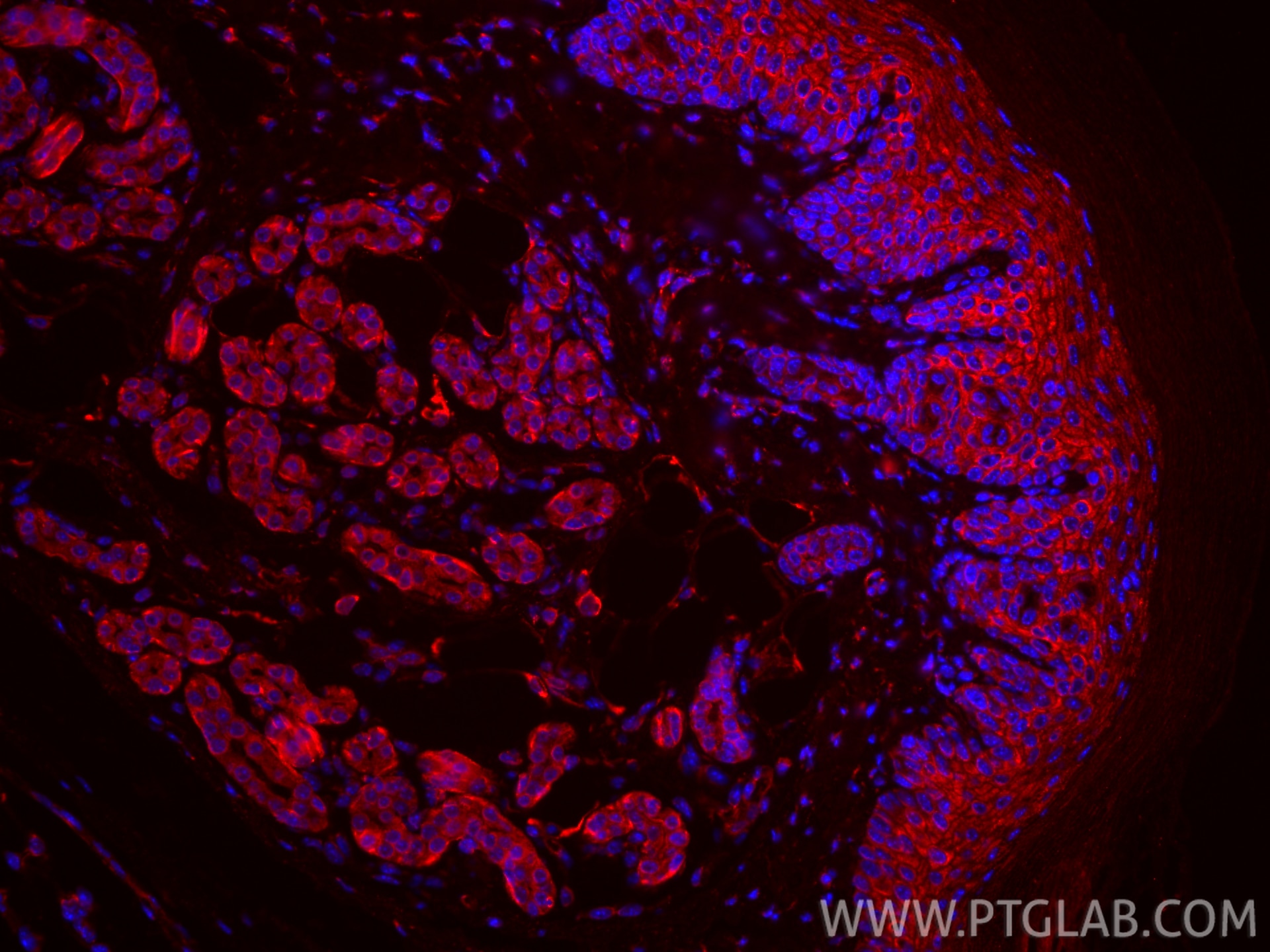 Immunofluorescence (IF) / fluorescent staining of mouse skin tissue using CoraLite®594-conjugated PTGER4 Monoclonal antibody (CL594-66921)