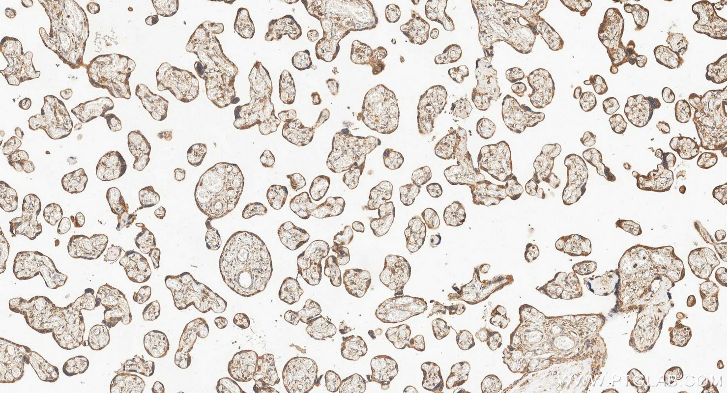IHC staining of human placenta using 10596-1-AP Immunohistochemistry (IHC) staining of human placenta tissue using PTGES Polyclonal antibody (10596-1-AP)