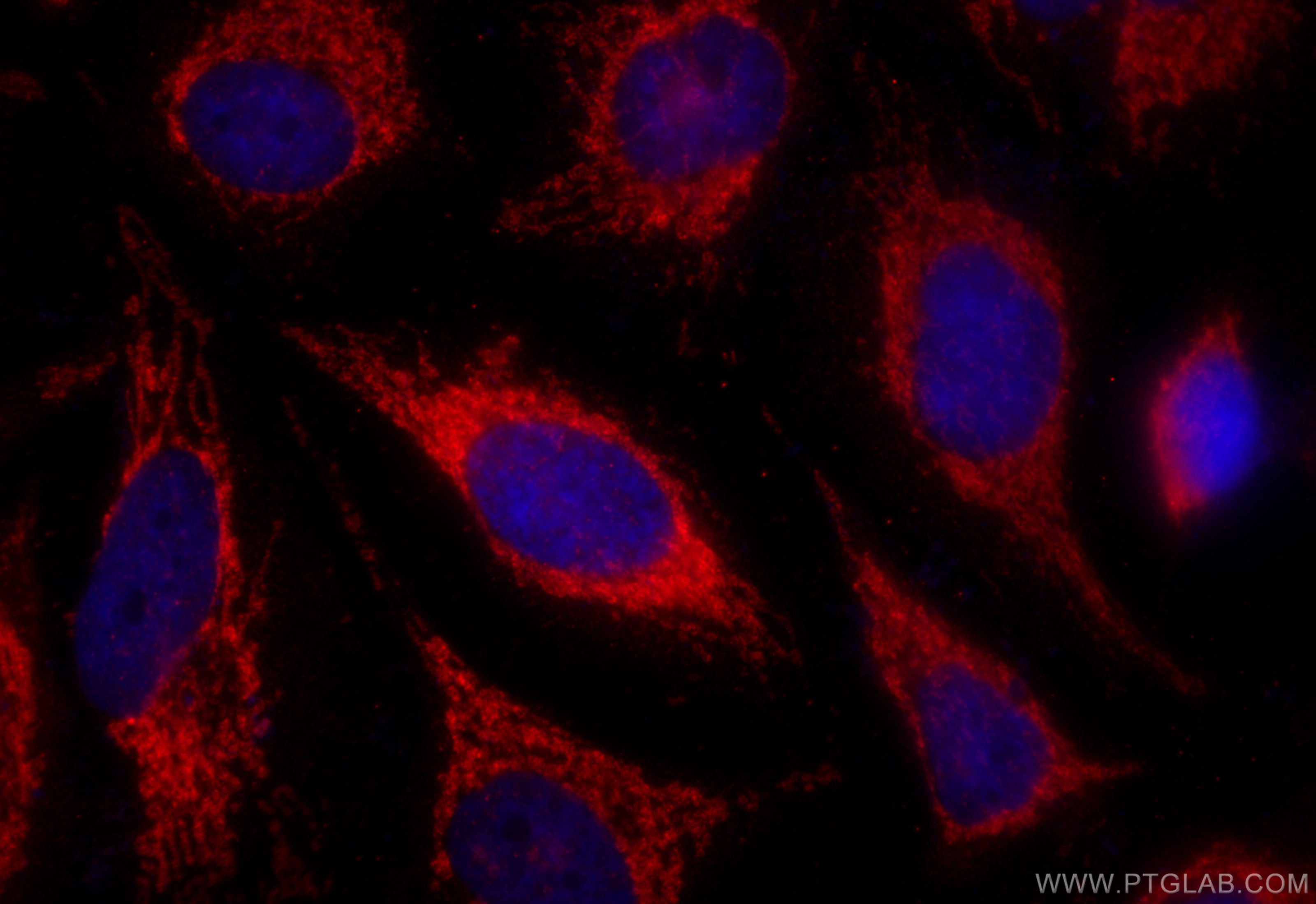 Immunofluorescence (IF) / fluorescent staining of HeLa cells using PTGES2 Polyclonal antibody (10881-1-AP)