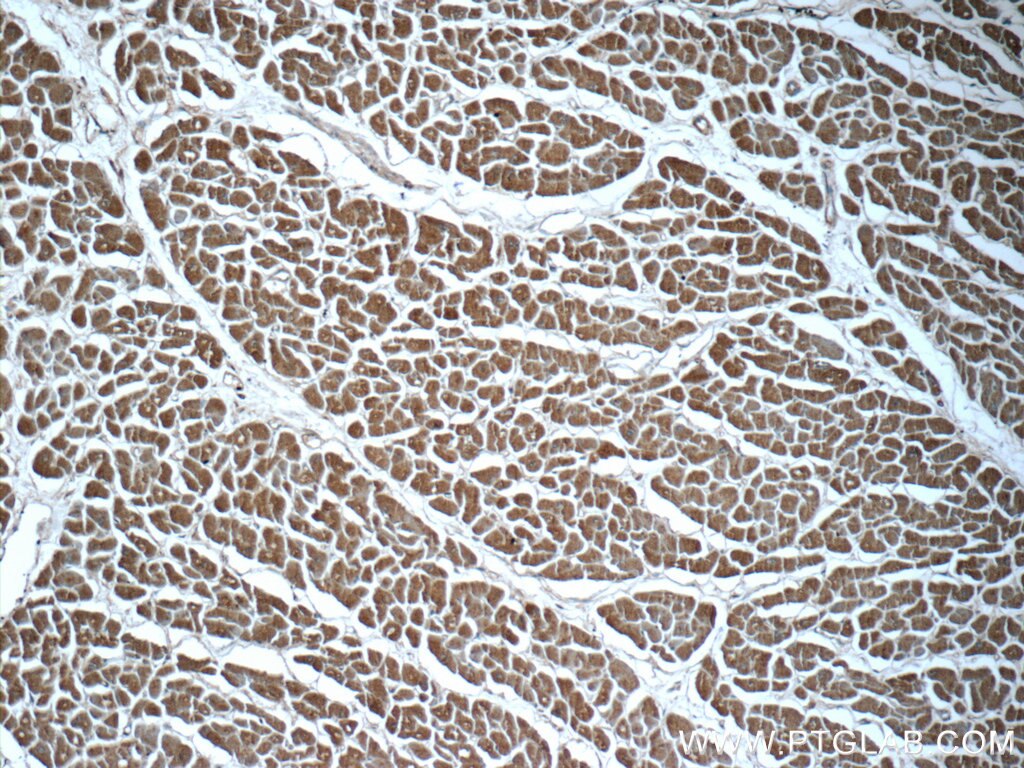 Immunohistochemistry (IHC) staining of human heart tissue using PTGES2 Polyclonal antibody (10881-1-AP)