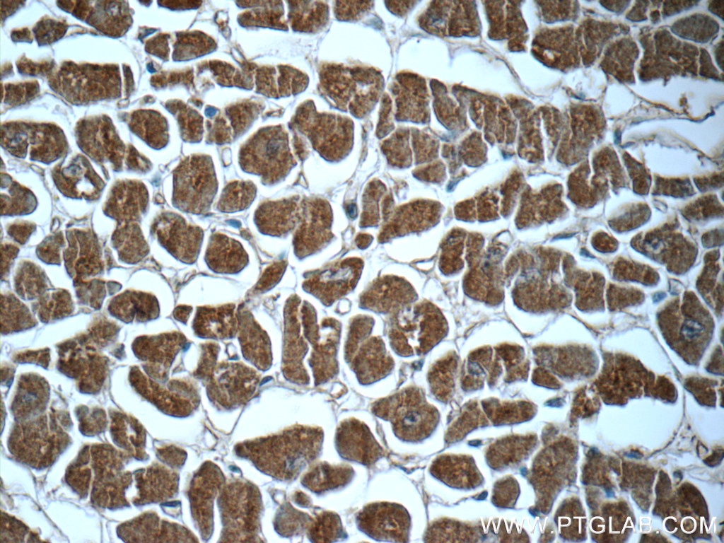 Immunohistochemistry (IHC) staining of human heart tissue using PTGES2 Polyclonal antibody (10881-1-AP)