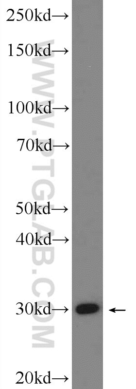 Western Blot (WB) analysis of HeLa cells using PTGES2 Polyclonal antibody (10881-1-AP)