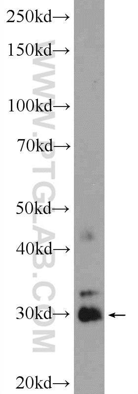 Western Blot (WB) analysis of mouse heart tissue using PTGES2 Polyclonal antibody (10881-1-AP)