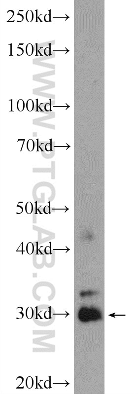 WB analysis of mouse heart using 10881-1-AP