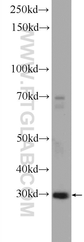 Western Blot (WB) analysis of HEK-293 cells using PTGES2 Polyclonal antibody (10881-1-AP)