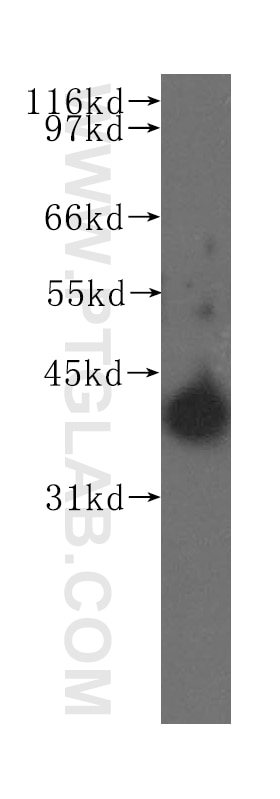 Western Blot (WB) analysis of human stomach tissue using PTGES2 Polyclonal antibody (10881-1-AP)