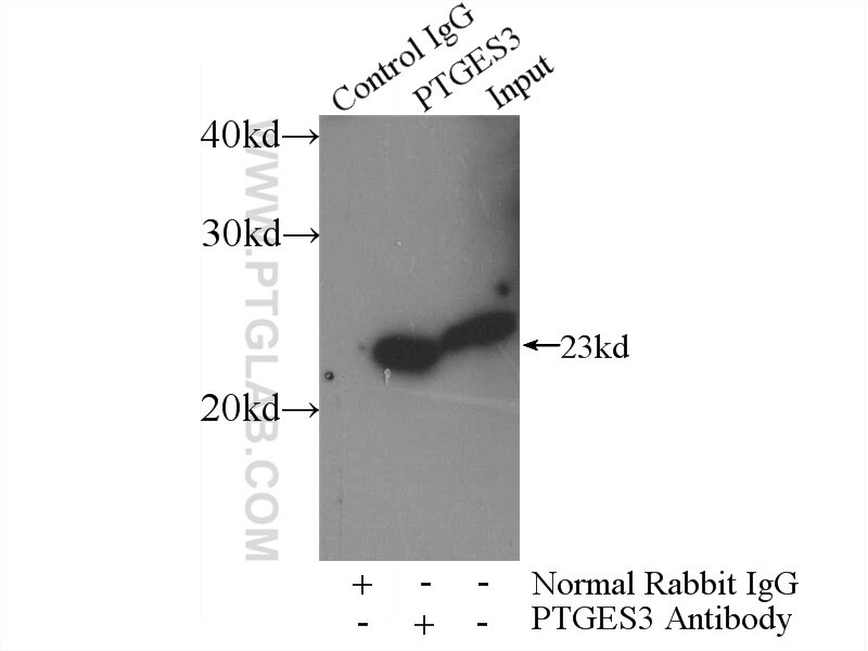 IP experiment of mouse heart using 15216-1-AP