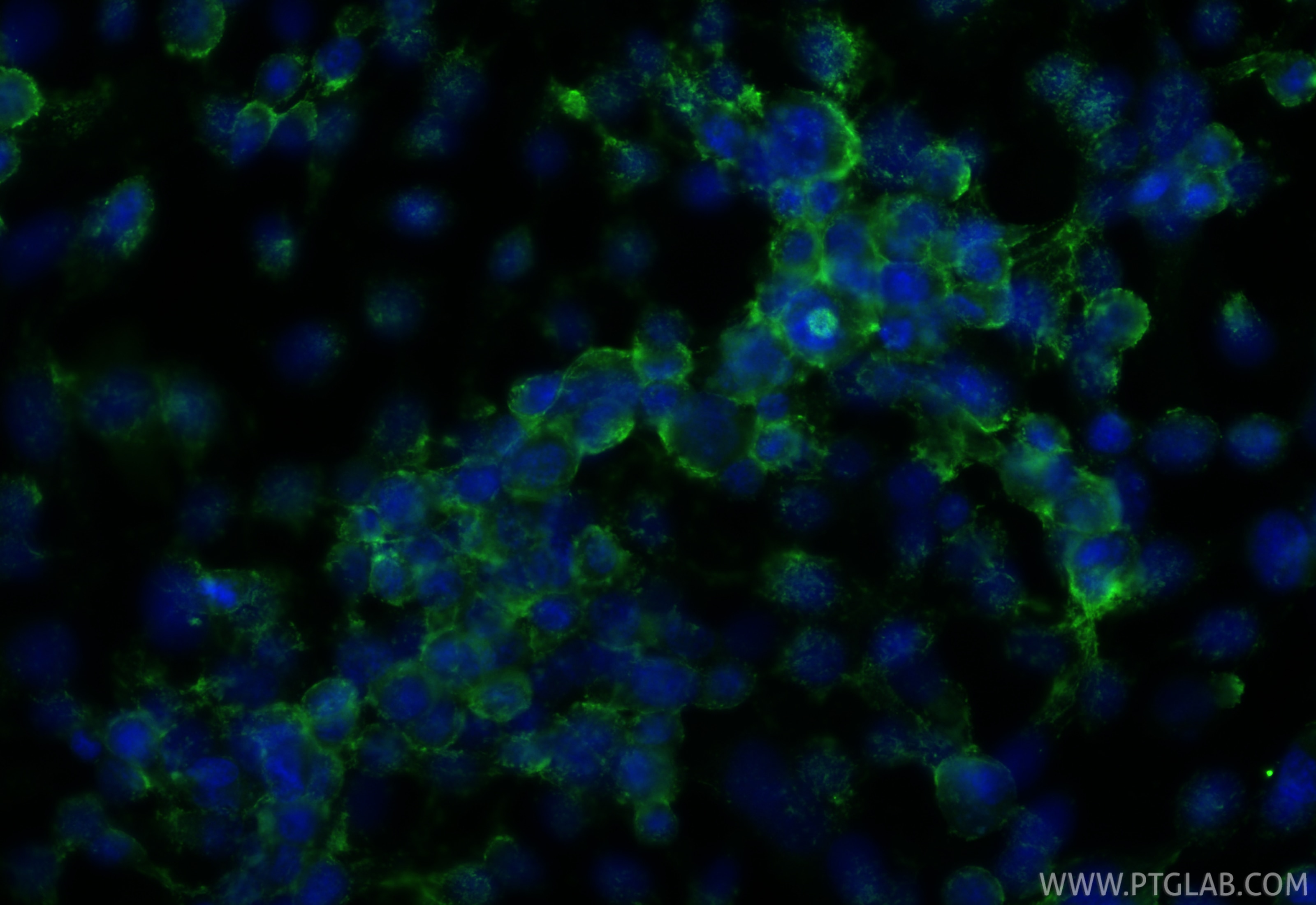 Immunofluorescence (IF) / fluorescent staining of PC-3 cells using PTGFR Polyclonal antibody (21595-1-AP)