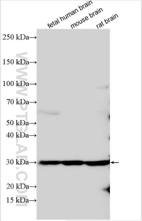 Western Blot (WB) analysis of various lysates using PTGFR Polyclonal antibody (21595-1-AP)