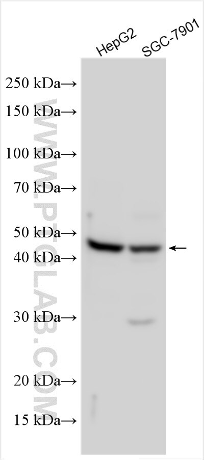 Western Blot (WB) analysis of various lysates using PTGIR Polyclonal antibody (30657-1-AP)