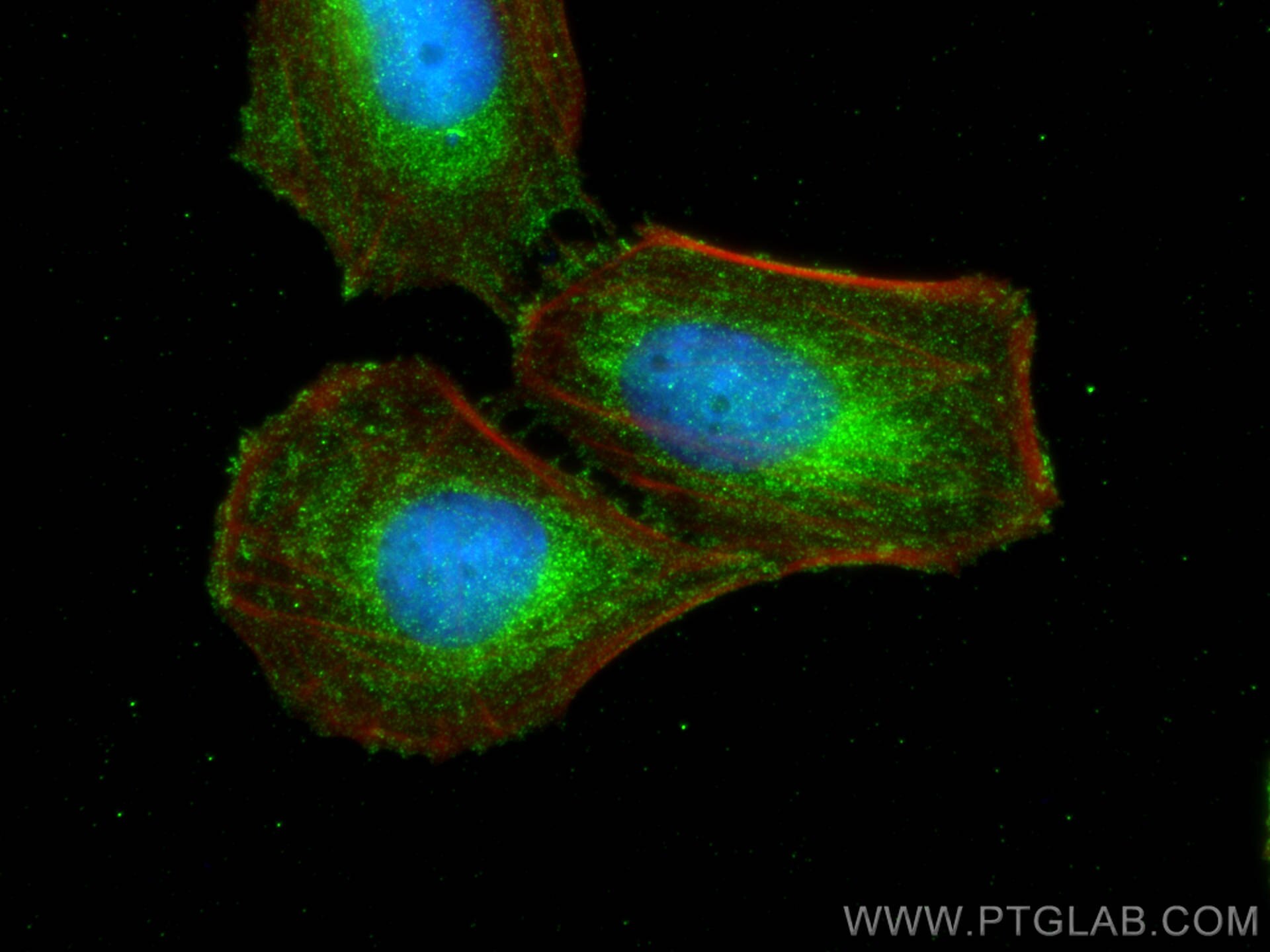 Immunofluorescence (IF) / fluorescent staining of Saos-2 cells using PTGIS Polyclonal antibody (27061-1-AP)