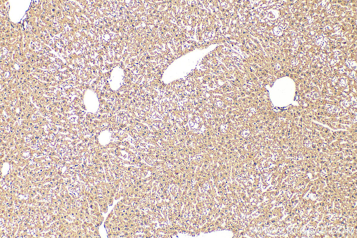 Immunohistochemistry (IHC) staining of mouse liver tissue using PTGIS Polyclonal antibody (27061-1-AP)