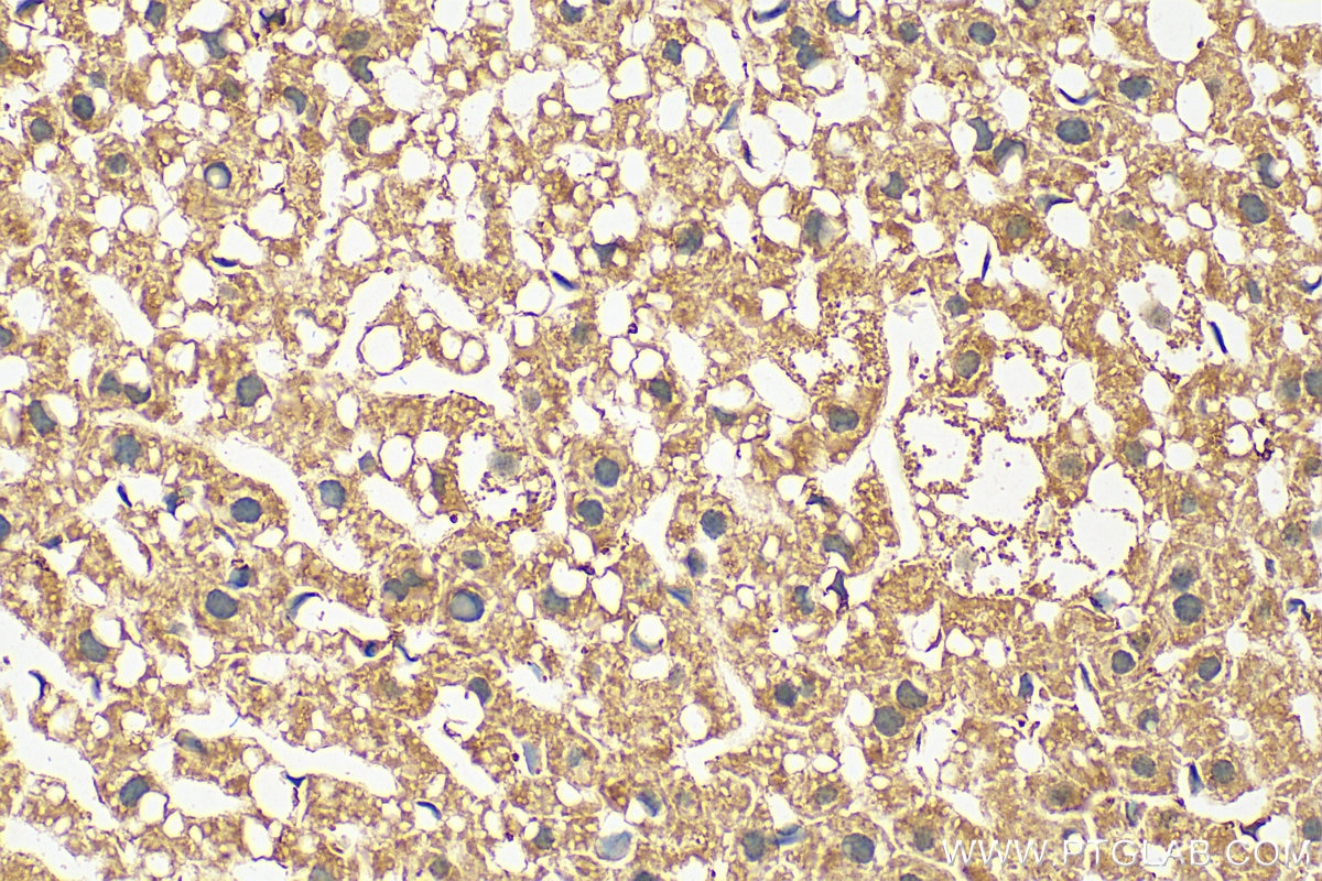 Immunohistochemistry (IHC) staining of mouse liver tissue using PTGIS Polyclonal antibody (27061-1-AP)