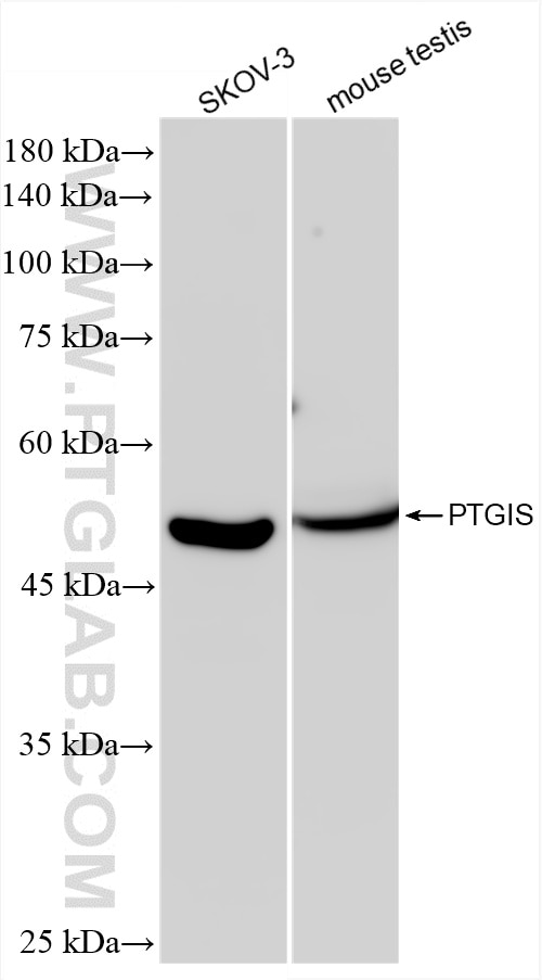 Western Blot (WB) analysis of various lysates using PTGIS Recombinant antibody (85810-1-RR)