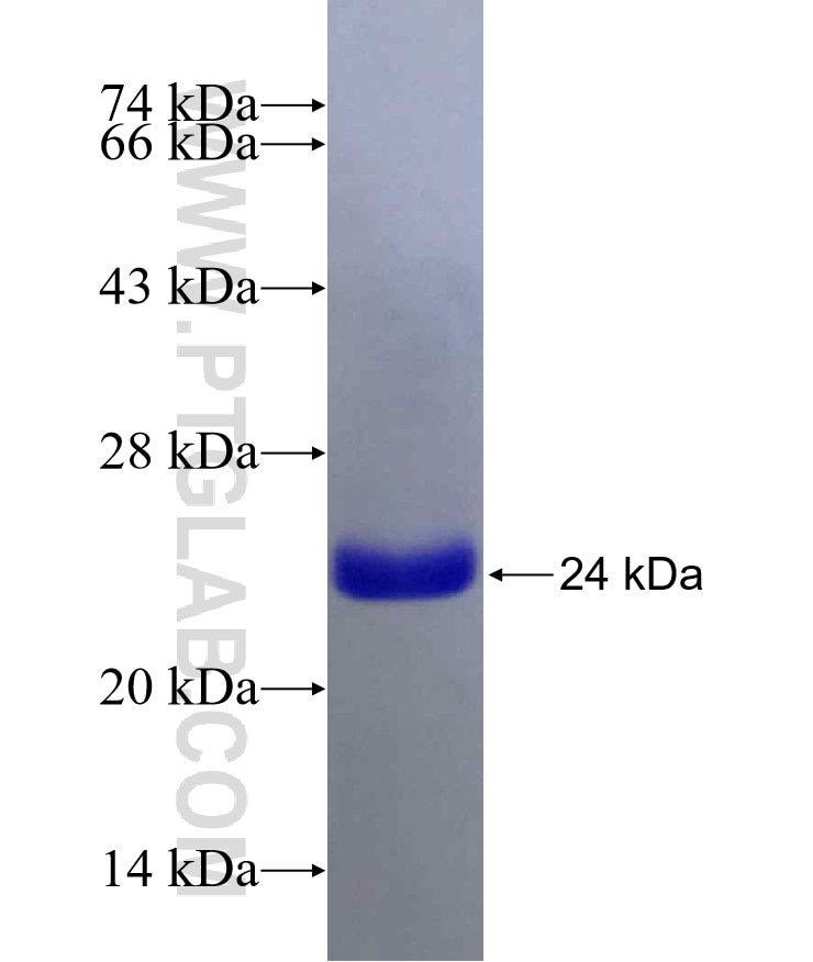 PTGIS fusion protein Ag25824 SDS-PAGE