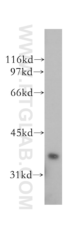 Western Blot (WB) analysis of human colon tissue using PTGR1 Polyclonal antibody (13374-1-AP)