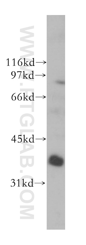 Western Blot (WB) analysis of human liver tissue using PTGR1 Polyclonal antibody (13374-1-AP)