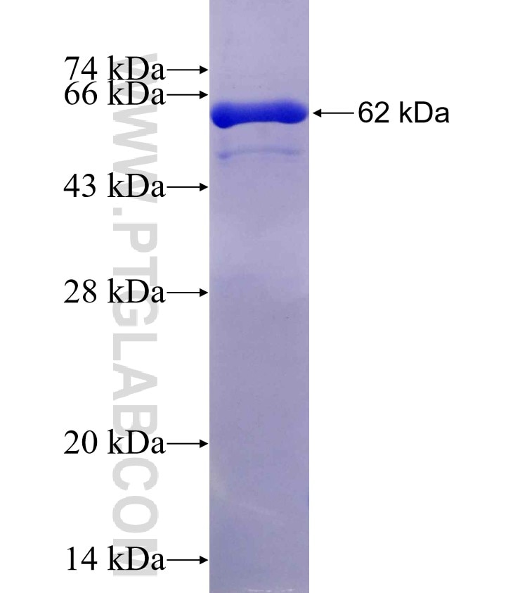 PTGR1 fusion protein Ag4196 SDS-PAGE