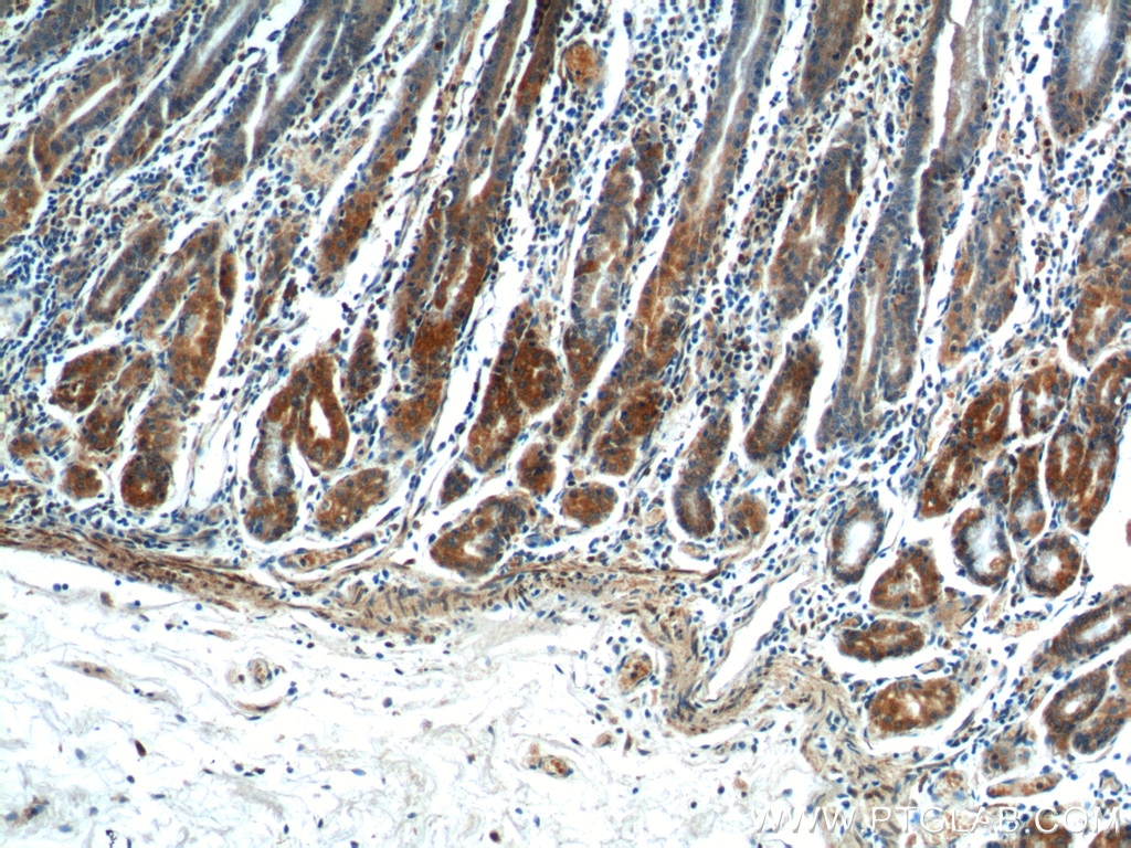 Immunohistochemistry (IHC) staining of human stomach tissue using COX-1/Cyclooxygenase-1 Polyclonal antibody (13393-1-AP)