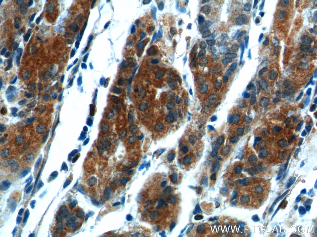 Immunohistochemistry (IHC) staining of human stomach tissue using COX-1/Cyclooxygenase-1 Polyclonal antibody (13393-1-AP)