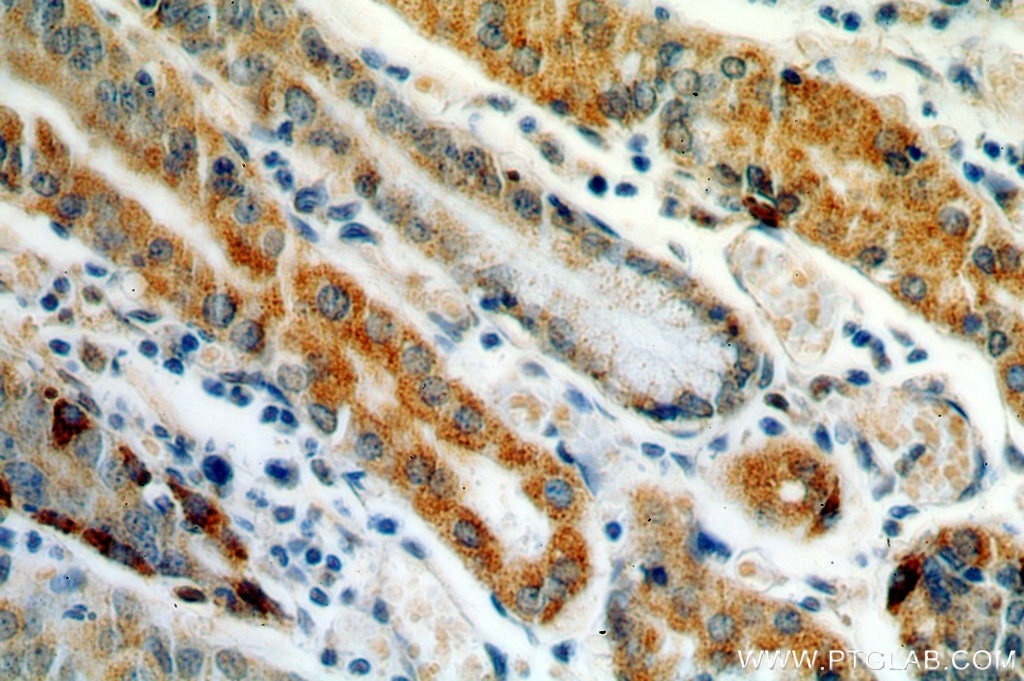 COX-1/Cyclooxygenase-1