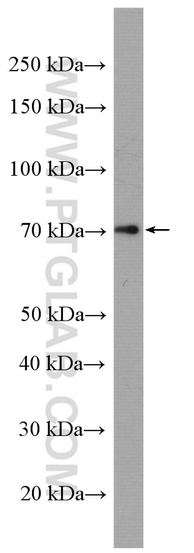 Western Blot (WB) analysis of Neuro-2a cells using COX-1/Cyclooxygenase-1 Polyclonal antibody (13393-1-AP)