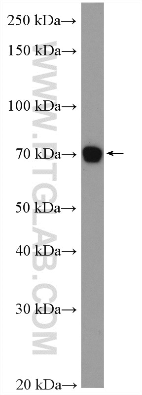 WB analysis of HeLa using 13393-1-AP