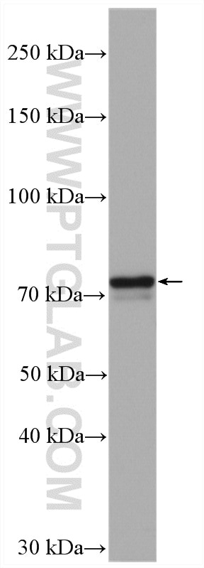 Western Blot (WB) analysis of HeLa cells using COX-1/Cyclooxygenase-1 Polyclonal antibody (13393-1-AP)