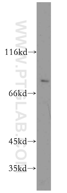 COX-1/Cyclooxygenase-1 Polyclonal antibody