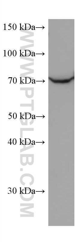 Western Blot (WB) analysis of K-562 cells using PTGS1 Monoclonal antibody (67346-1-Ig)
