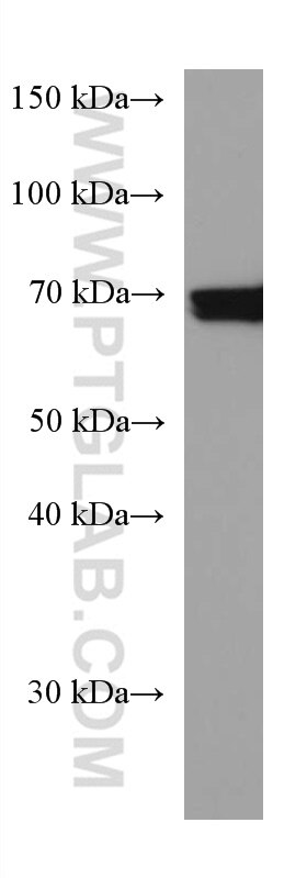 Western Blot (WB) analysis of A431 cells using PTGS1 Monoclonal antibody (67346-1-Ig)