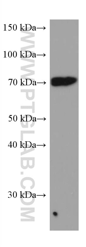 Western Blot (WB) analysis of human peripheral blood leukocyte using PTGS1 Monoclonal antibody (67346-1-Ig)