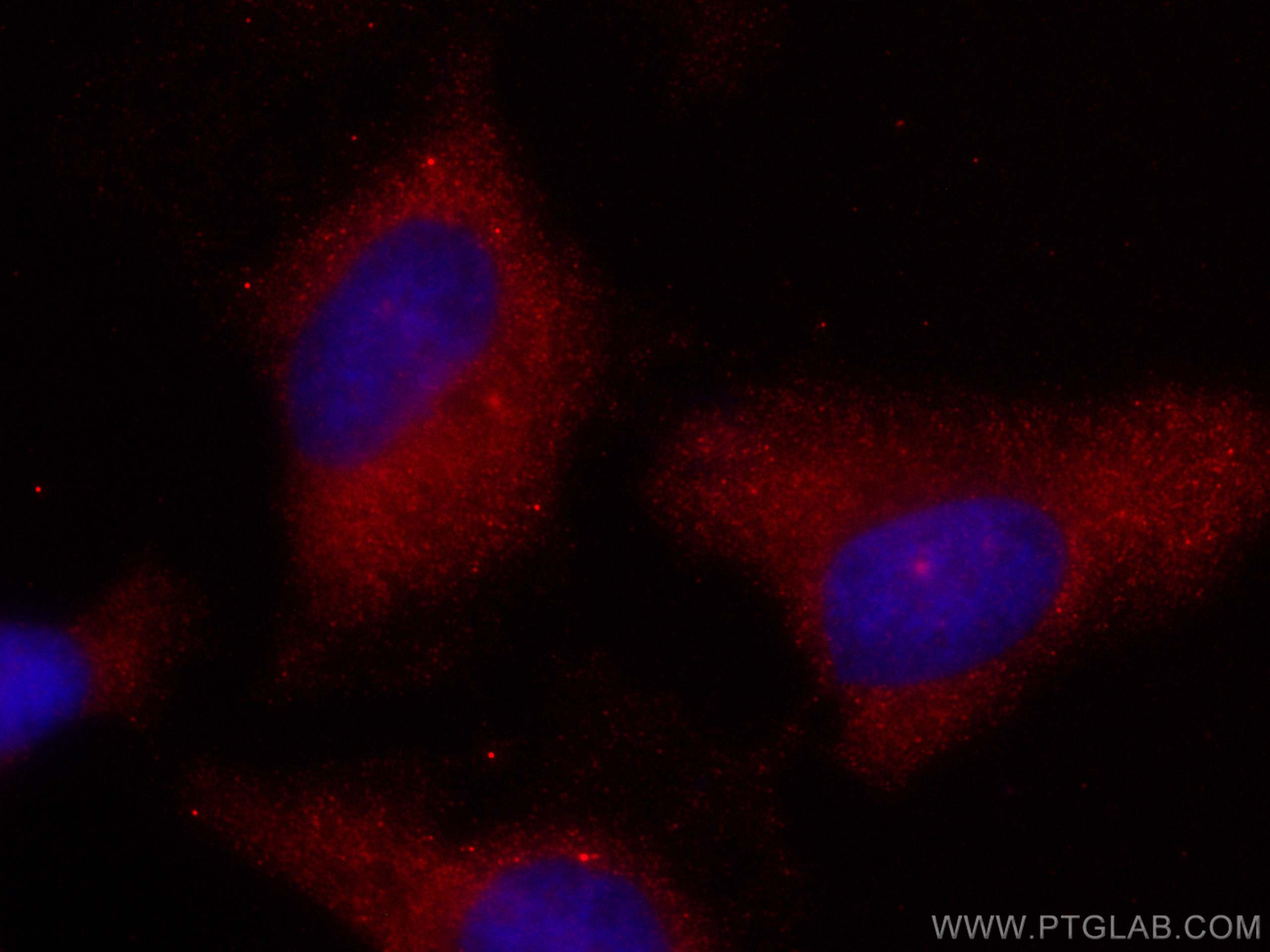 Immunofluorescence (IF) / fluorescent staining of HeLa cells using CoraLite®594-conjugated PTGS1 Monoclonal antibody (CL594-67346)